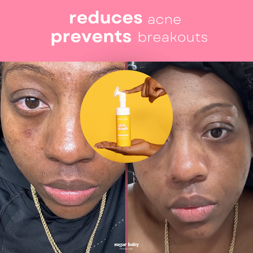Turmeric & Kojic Acid Glow Wash - Buy 1 Get 1 FREE